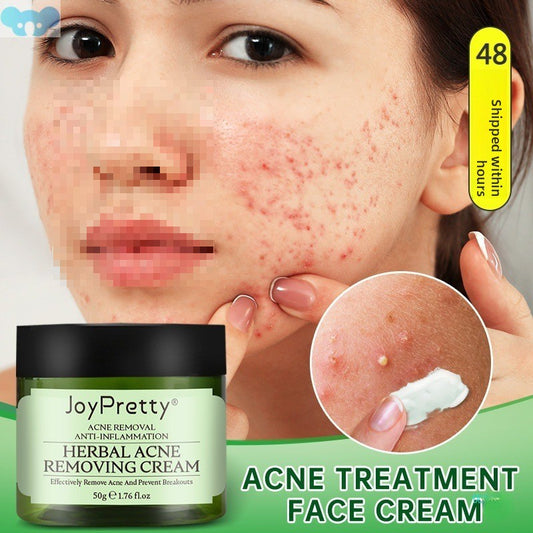 Herbal Acne Face Cream for Scar Removal