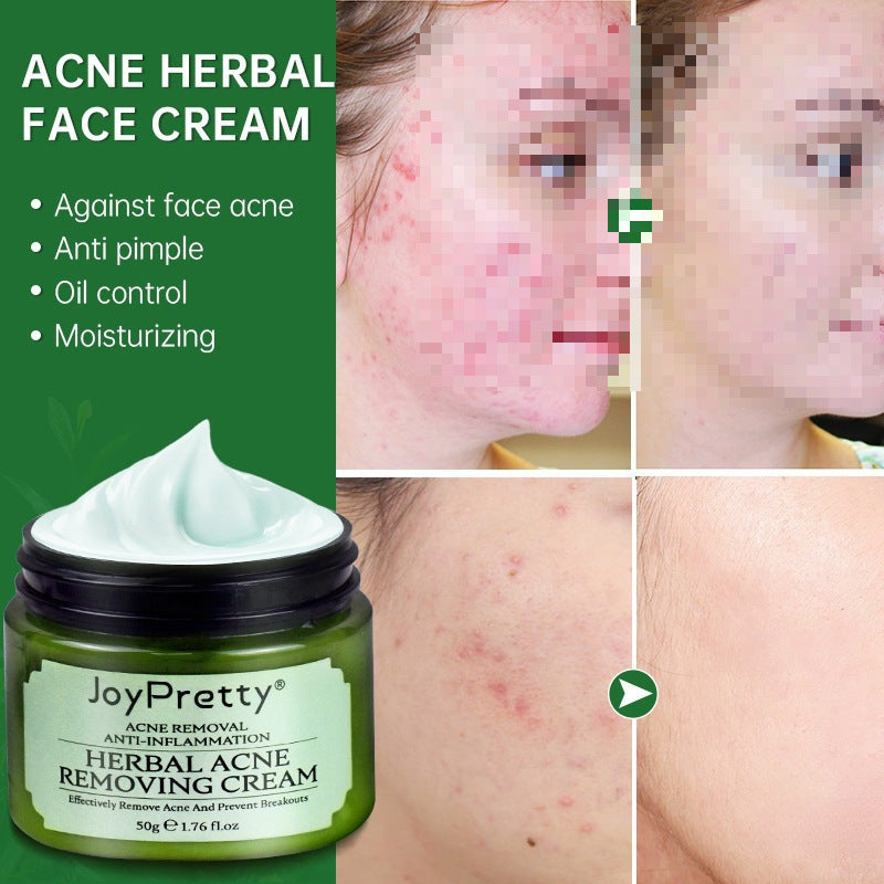 Herbal Acne Face Cream for Scar Removal